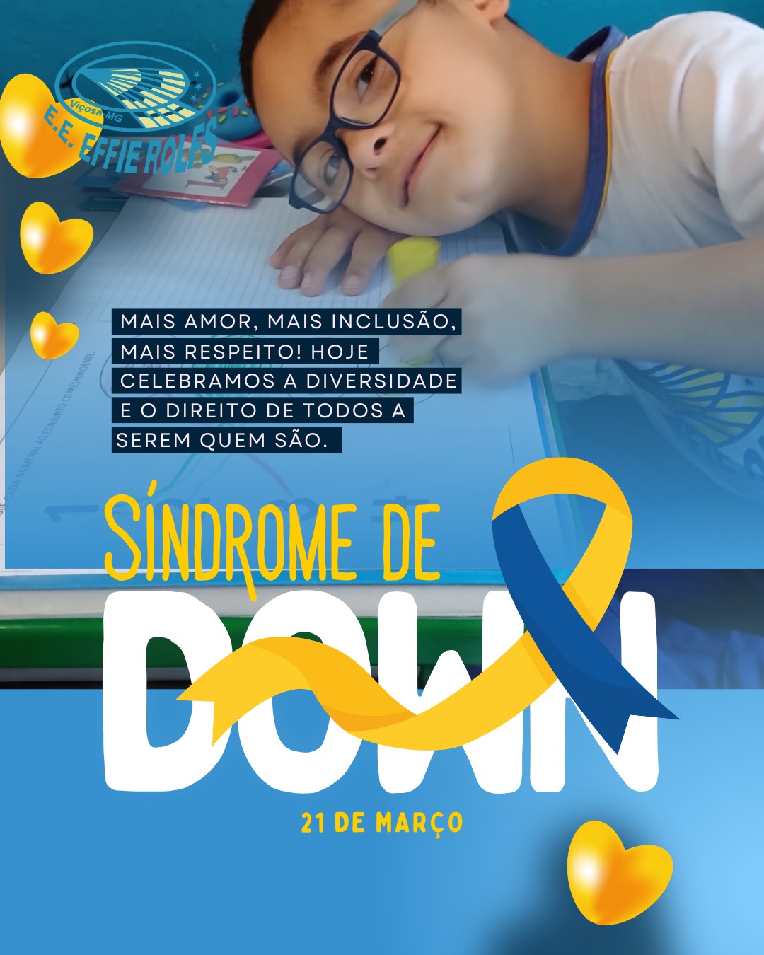 Imagem de uma criança com Síndrome de Down, junto com o texto 